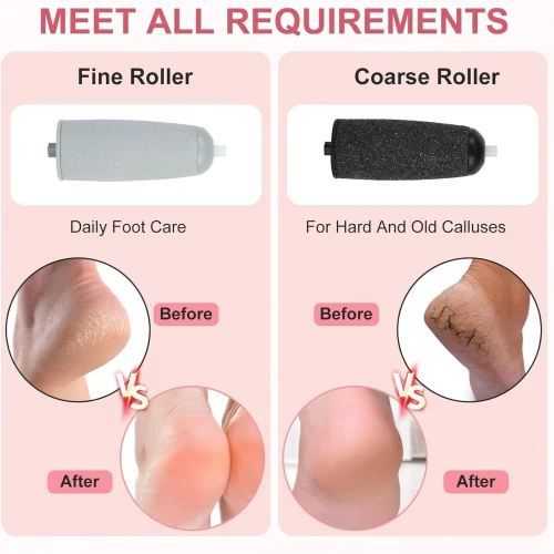 أداة إزالة الجلد الميت، جهاز باديكير قابل لإعادة الشحن لأقدام النساء مع رأسين دوارين، مجموعة باديكير للنساء للقدم من فيلون